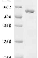 Human C-C motif chemokine 17 (CCL17), Biotinylated Recombinant Protein - BioCrest Sci