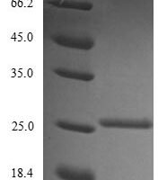 Human Bone morphogenetic protein 2 (BMP2) Recombinant Protein, N-His, aa 283–396, Yeast - BioCrest Sci