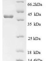Human Advanced glycosylation end product-specific receptor (AGER), partial Recombinant Protein - BioCrest Sci