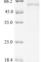Human Ras-related protein Rab-12 (RAB12) Recombinant Protein, C-hFc1 - BioCrest Sci