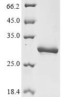 Horse Prolactin (PRL) Recombinant Protein, N-His - BioCrest Sci