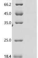 Human Protein ADM2 (ADM2), partial Recombinant Protein, C-His - BioCrest Sci