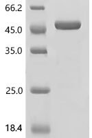Human Alcohol dehydrogenase 1C (ADH1C) Recombinant Protein, C-His - BioCrest Sci