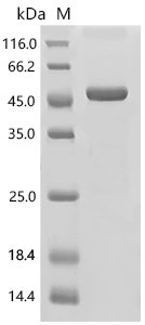 Human Alcohol dehydrogenase 1C (ADH1C) Recombinant Protein, C-His, E.coli, C-terminal 6xHis-tagged, 46.8 kDa, purity >≥ 85% as determined by SDS-PAGE.