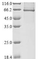 Human E3 ubiquitin-protein ligase RNF8 (RNF8) Recombinant Protein - BioCrest Sci
