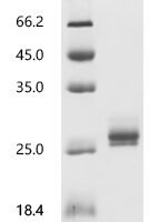 Human Interleukin-11 (IL11) Recombinant Protein, N-10His - BioCrest Sci