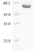 Blomia tropicalis Alpha-amylase Recombinant Protein - BioCrest Sci