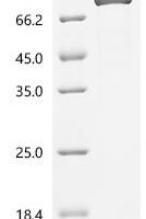 Rat Peptidylglycine alpha-amidating monooxygenase (Pam), partial Recombinant Protein, C-8His - BioCrest Sci