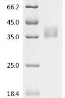 Rat Tonin (Klk2) Recombinant Protein, C-His, aa 25–259, Mammalian cell - BioCrest Sci