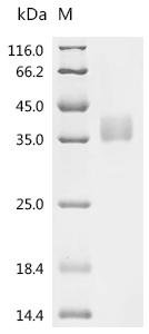 Rat Tonin (Klk2) Recombinant Protein, C-His, aa 25–259, Mammalian cell, Rattus norvegicus (Rat), Mammalian cell, C-terminal 6xHis-tagged, 27.8 kDa, purity >≥ 95% as determined by SDS-PAGE.