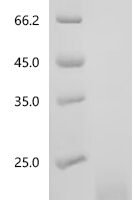 Human Activin receptor type-1B (ACVR1B), partial Recombinant Protein - BioCrest Sci