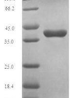 Human Oncostatin-M (OSM) Recombinant Protein - BioCrest Sci