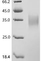 Human Fibroblast growth factor 8 (FGF8) Recombinant Protein - BioCrest Sci