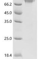 Mouse Placenta-expressed transcript 1 protein (Plet1) Recombinant Protein, C-hFc1 - BioCrest Sci