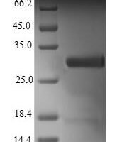 Human Uncharacterized protein C1orf54 (C1orf54) Recombinant Protein, N-His-B2M - BioCrest Sci