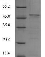 Human Cytochrome b-245 heavy chain (CYBB), partial Recombinant Protein, N-His-SUMO - BioCrest Sci
