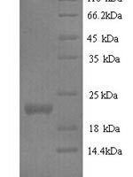 Mouse Interferon epsilon (Ifne) Recombinant Protein, N-His, aa 22–192, Yeast - BioCrest Sci