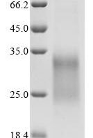 Mouse IGF-like family receptor 1 (Igflr1), partial Recombinant Protein, C-10His - BioCrest Sci