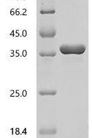 Orthopoxvirus vaccinia Cell surface-binding protein OPG105 (D8L), partial Recombinant Protein, C-His - BioCrest Sci