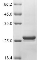 Escherichia coli FMN reductase (NADPH) (ssuE) Recombinant Protein - BioCrest Sci
