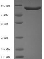 Human Syntaphilin (SNPH), partial Recombinant Protein - BioCrest Sci