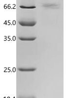 Human T-cell leukemia virus 3 Envelope glycoprotein gp63 (env), partial Recombinant Protein, C-10His - BioCrest Sci