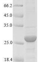 Cat Serum amyloid A protein (SAA1), partial Recombinant Protein - BioCrest Sci