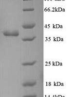 Escherichia coli Methyl-accepting chemotaxis protein I (tsr), partial Recombinant Protein - BioCrest Sci