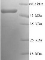 Human Calponin-1 (CNN1) Recombinant Protein - BioCrest Sci