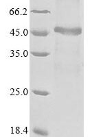 Human O-acetyl-ADP-ribose deacetylase MACROD1 (MACROD1) Recombinant Protein - BioCrest Sci