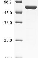 Human Transcriptional regulator ERG (ERG) Recombinant Protein, N-His, Isoform 1 - BioCrest Sci