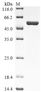 Human Transcriptional regulator ERG (ERG) Recombinant Protein, N-His, Isoform 1, Homo sapiens (Human), E.coli, N-terminal 6xHis-tagged, 57.8 kDa, purity >≥ 85% as determined by SDS-PAGE.