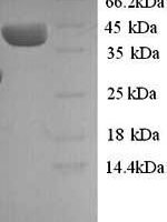 Human ELAV-like protein 3 (ELAVL3) Recombinant Protein, N-His, aa 1–367, Yeast - BioCrest Sci