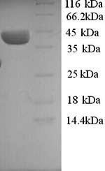 Human ELAV-like protein 3 (ELAVL3) Recombinant Protein, N-His, aa 1–367, Yeast, Homo sapiens (Human), Yeast, N-terminal 6xHis-tagged, 41.5 kDa, purity >≥ 90% as determined by SDS-PAGE.