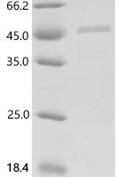 Mouse Protein MENT (Ment) Recombinant Protein - BioCrest Sci