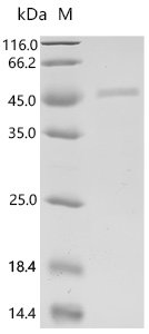 Mouse Protein MENT (Ment) Recombinant Protein, Mus musculus (Mouse), E.coli, C-terminal 6xHis-tagged, 42.6 kDa, purity >≥ 85% as determined by SDS-PAGE.