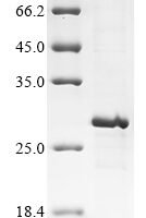 Mouse Prokineticin-2 (Prok2) Recombinant Protein, N-His-B2M - BioCrest Sci