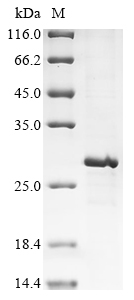 Mouse Prokineticin-2 (Prok2) Recombinant Protein, N-His-B2M, Mus musculus (Mouse), E.coli, N-terminal 6xHis-B2M-tagged, 25.5 kDa, purity >≥ 85% as determined by SDS-PAGE.
