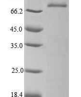 Platelet glycoprotein Ib alpha chain (GP1BA) for Homo sapiens (Human) Recombinant Protein - BioCrest Sci