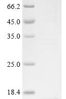 Mesocricetus auratus Interleukin-4 (Il4) Recombinant Protein - BioCrest Sci