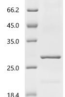 Human cytomegalovirus Enhanced green fluorescent protein (egfp) Recombinant Protein, N-His-IaN - BioCrest Sci