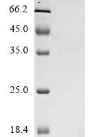 Severe acute respiratory syndrome coronavirus 2 Spike glycoprotein (S) (N501Y,P681H), partial Recombinant Protein, C-mFC - BioCrest Sci