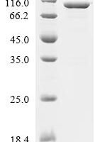 Escherichia coli Phenylalanine--tRNA ligase beta subunit (pheT) Recombinant Protein - BioCrest Sci