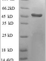 Human Heterogeneous nuclear ribonucleoprotein H (HNRNPH1), partial Recombinant Protein - BioCrest Sci