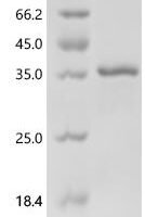 Bovine Beta-defensin 5 (DEFB5) Recombinant Protein, C-GST - BioCrest Sci