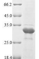 Escherichia coli Type 1 fimbrin D-mannose specific adhesin (fimH) Recombinant Protein, N-His, aa 22–300, E.coli - BioCrest Sci
