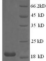 Chicken Collagen alpha-1 (XII) chain (COL12A1), partial Recombinant Protein, N-His, aa 139–311, E.coli - BioCrest Sci