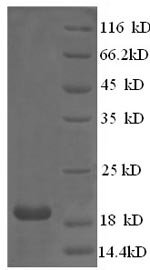 Chicken Collagen alpha-1 (XII) chain (COL12A1), partial Recombinant Protein, N-His, aa 139–311, E.coli, Gallus gallus (Chicken), E.coli, N-terminal 6xHis-tagged, 23.3 kDa, purity >≥ 90% as determined by SDS-PAGE.