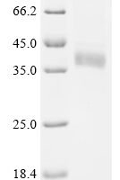 Human Deoxyribonuclease-1 (DNASE1) Recombinant Protein, C-10His - BioCrest Sci