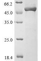 Human Alpha-1,3-mannosyl-glycoprotein 4-beta-N-acetylglucosaminyltransferase A (MGAT4A), partial Recombinant Protein, N-His - BioCrest Sci